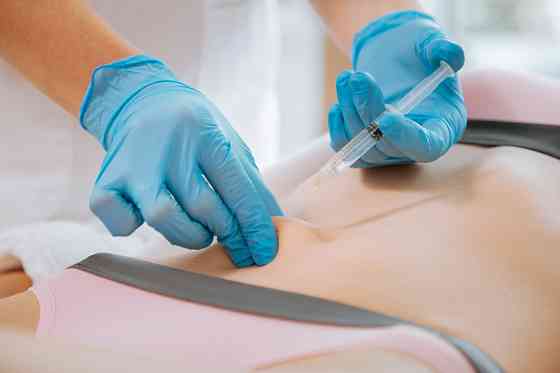 Мезотерапия тела Санкт-Петербург