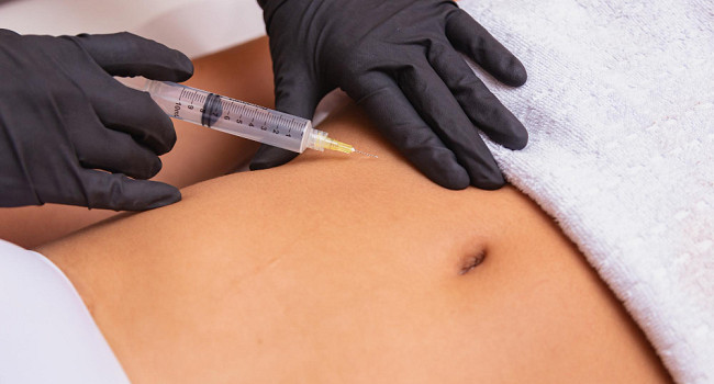 Мезотерапия тела Санкт-Петербург - изображение 3