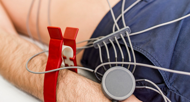 ЭКГ с расшифровкой Санкт-Петербург - изображение 1