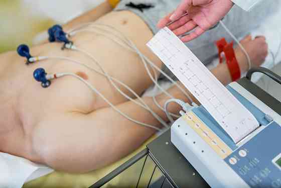 Экг без расшифровки Санкт-Петербург