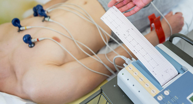 Экг без расшифровки Санкт-Петербург - изображение 2