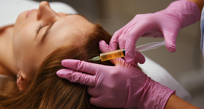 Плазмотерапия волосистой части головы Санкт-Петербург - изображение 2