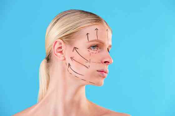 RF-лифтинг лица в салоне красоты "Стиль" Санкт-Петербург