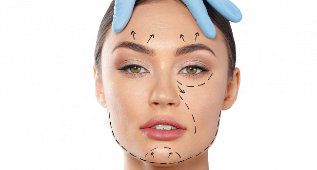 RF-лифтинг лица в салоне красоты "Стиль" Санкт-Петербург - изображение 1