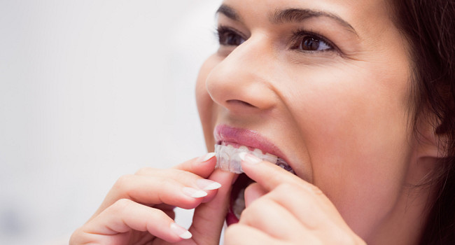 Трейнеры в стоматологии "АннетСтом" Санкт-Петербург - изображение 2