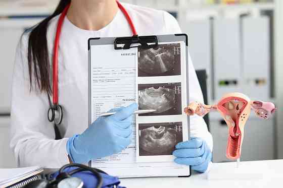 Фолликулометрия Санкт-Петербург