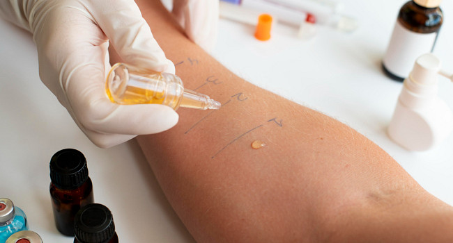 Консультация аллерголога Санкт-Петербург - изображение 3