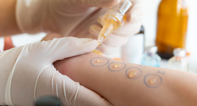 Прием аллерголога Санкт-Петербург - изображение 3