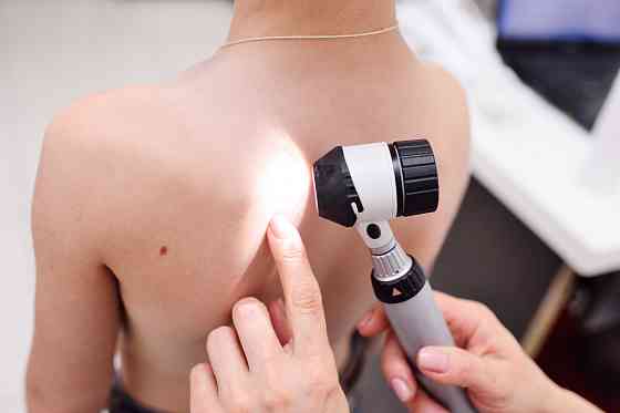 Консультация врача-дерматовенеролога Санкт-Петербург