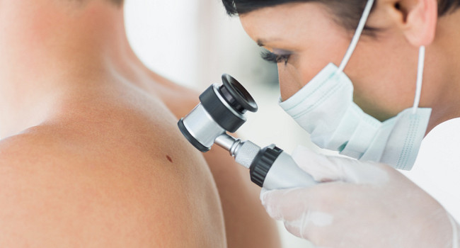 Консультация врача-дерматовенеролога Санкт-Петербург - изображение 3