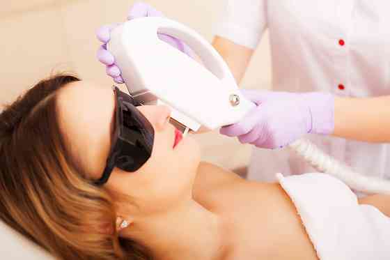 Лазерная эпиляция лица Санкт-Петербург