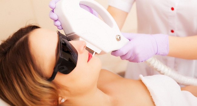 Лазерная эпиляция лица Санкт-Петербург - изображение 2