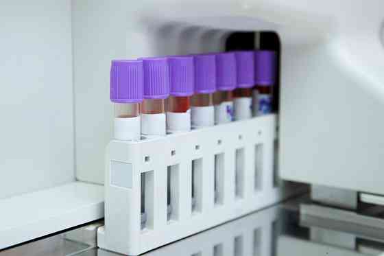 Анализы со скидкой до 30% Санкт-Петербург