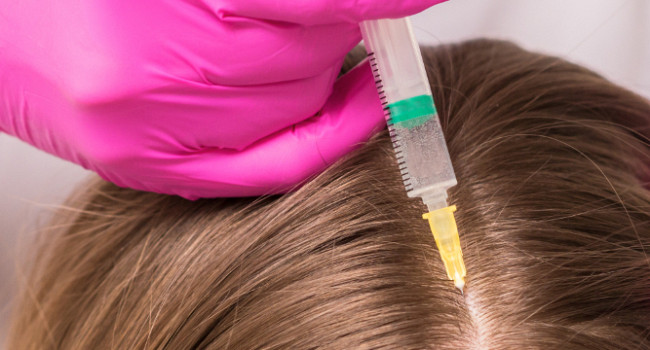 Мезотерапия волос Санкт-Петербург - изображение 1