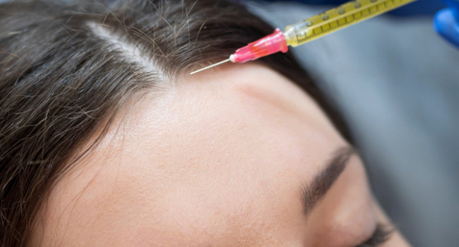 Мезотерапия волос Санкт-Петербург - изображение 2