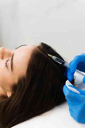 Мезотерапия волос Санкт-Петербург