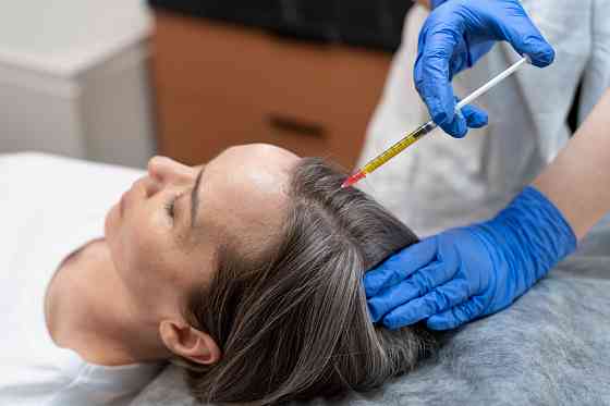 Плазмотерапия волосистой части головы Санкт-Петербург