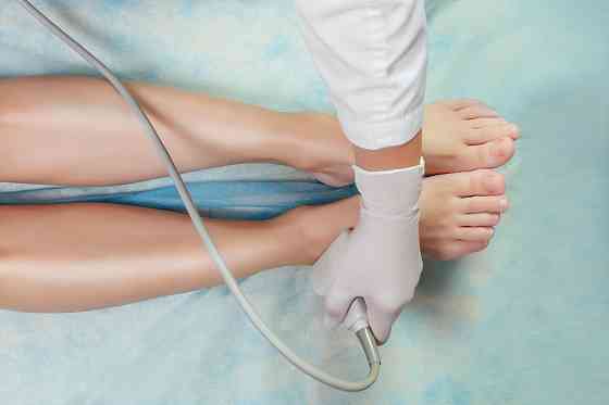 УЗИ вен нижних конечностей (дуплексное сканирование) Санкт-Петербург