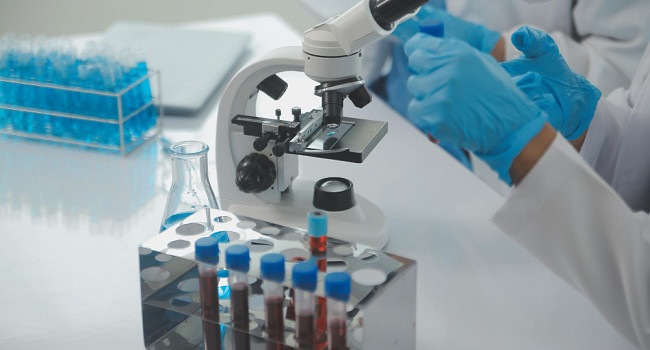 Иммунологическое обследование (расширенное) Санкт-Петербург - изображение 2