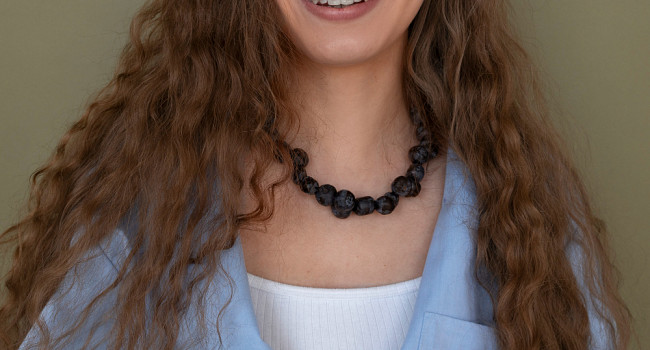 Зубные украшения Санкт-Петербург - изображение 2