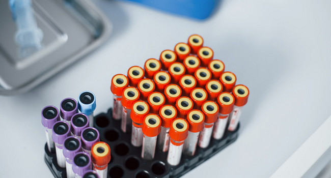 Аллергологические исследования Санкт-Петербург - изображение 2