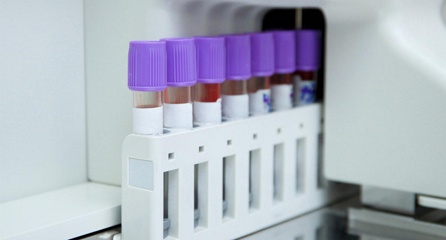 Аллергопробы Санкт-Петербург - изображение 2