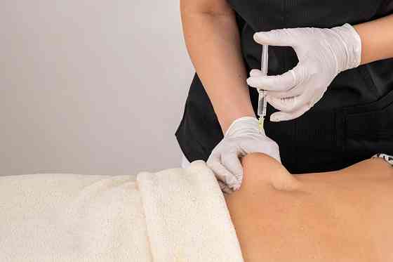 Ботулинотерапия тела Санкт-Петербург