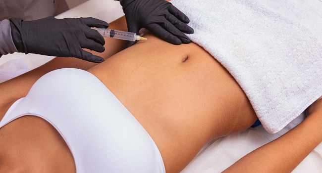 Процедура плазмотерапии (плазмолифтинга) Санкт-Петербург - изображение 1