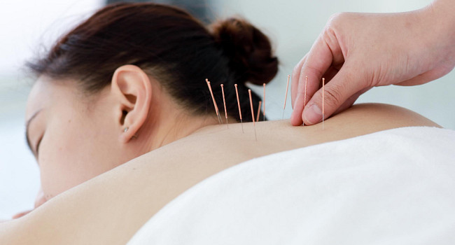 Иглоукалывание в медицинском центре «Два крыла» Санкт-Петербург - изображение 2