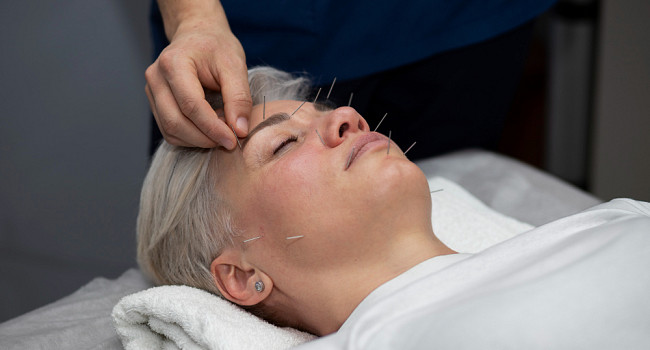 Иглоукалывание в медицинском центре «Два крыла» Санкт-Петербург - изображение 5