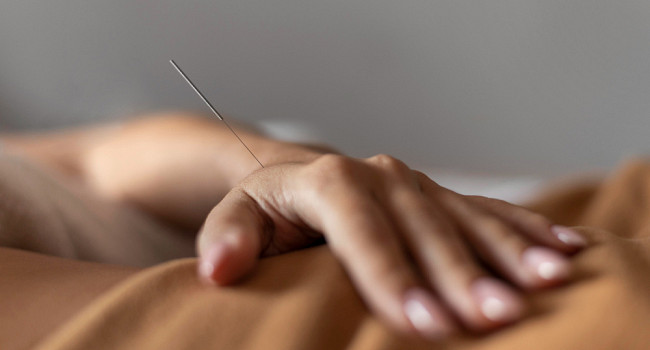 Иглоукалывание в медицинском центре «Два крыла» Санкт-Петербург - изображение 4