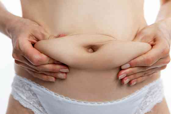 Пластика живота (абдоминопластика) Санкт-Петербург