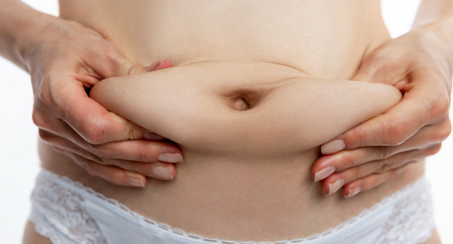 Пластика живота (абдоминопластика) Санкт-Петербург - изображение 2