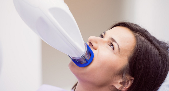 Отбеливание зубов в клинике «Томсон» Санкт-Петербург - изображение 2