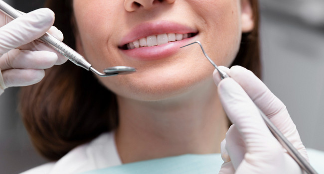 Отбеливание зубов Санкт-Петербург - изображение 2